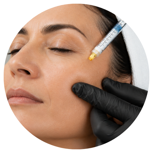 Radiesse para restaurar volumen y firmeza facial