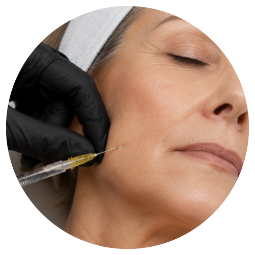Sculptra para bioestimulación facial progresiva